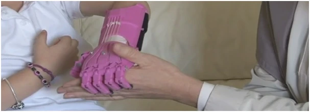 A Bionic Arm Holding another hand. 
